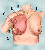 axillary_lymph_nodes_tcm-small