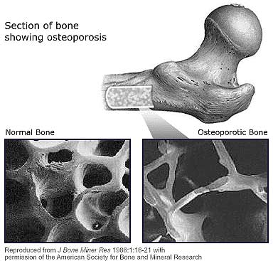 bone_section