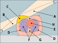 radiation_trea