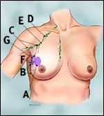 pre_surgery_step3_tcm8-small